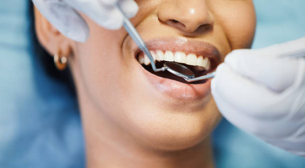 Best 24-Hour Emergency Dentist in Tladega, AL