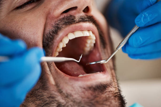 Best Urgent Care for Lost Fillings or Crowns in Tladega, AL
