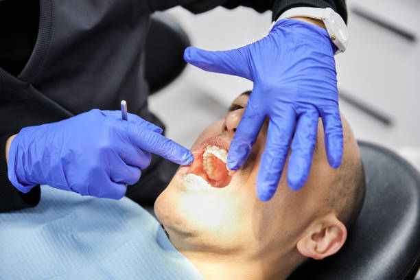Best Emergency Gum Treatment in Tladega, AL